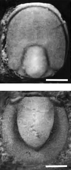 Lisogoragnostus hybus, a Cambrian trilobite fossil from Hunan.